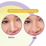DR.Rashel Nose Pore Strips For Pore Cleansing | Deep Cleansing Nose Strips For Instant And Painless Blackheads Removal | Deep Purifying Blackhead Remover Strips for Nose | 10 PCS (De-Tan)