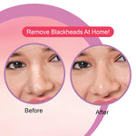 DR.Rashel Strawberry Nose Strips For Pore Cleansing | Nose Pore Strips For Painless Blackheads Removal | Instant Blackhead Remover Strips for Nose | 10 PCS