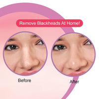 DR.Rashel Strawberry Nose Strips For Pore Cleansing | Nose Pore Strips For Painless Blackheads Removal | Instant Blackhead Remover Strips for Nose | 10 PCS