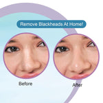 DR.Rashel Hyaluronic Nose Pore Strips For Pore Cleansing | Deep Cleansing Nose Strips For Painless Blackheads Removal | Deep Purifying Strips for Nose | 10 PCS
