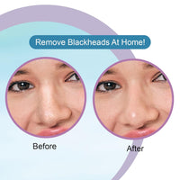 DR.Rashel Hyaluronic Nose Pore Strips For Pore Cleansing | Deep Cleansing Nose Strips For Painless Blackheads Removal | Deep Purifying Strips for Nose | 10 PCS