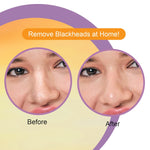 DR.Rashel Nose Pore Strips For Pore Cleansing | Deep Cleansing Nose Strips For Instant And Painless Blackheads Removal | Deep Purifying Blackhead Remover Strips for Nose | 10 PCS (Vitamin C)